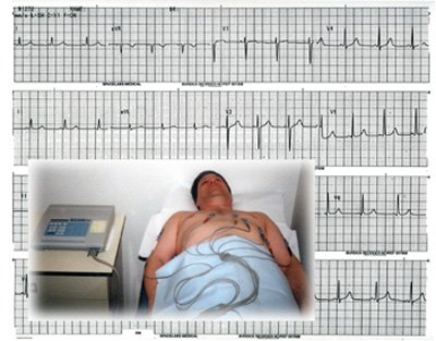 EKG.jpg
